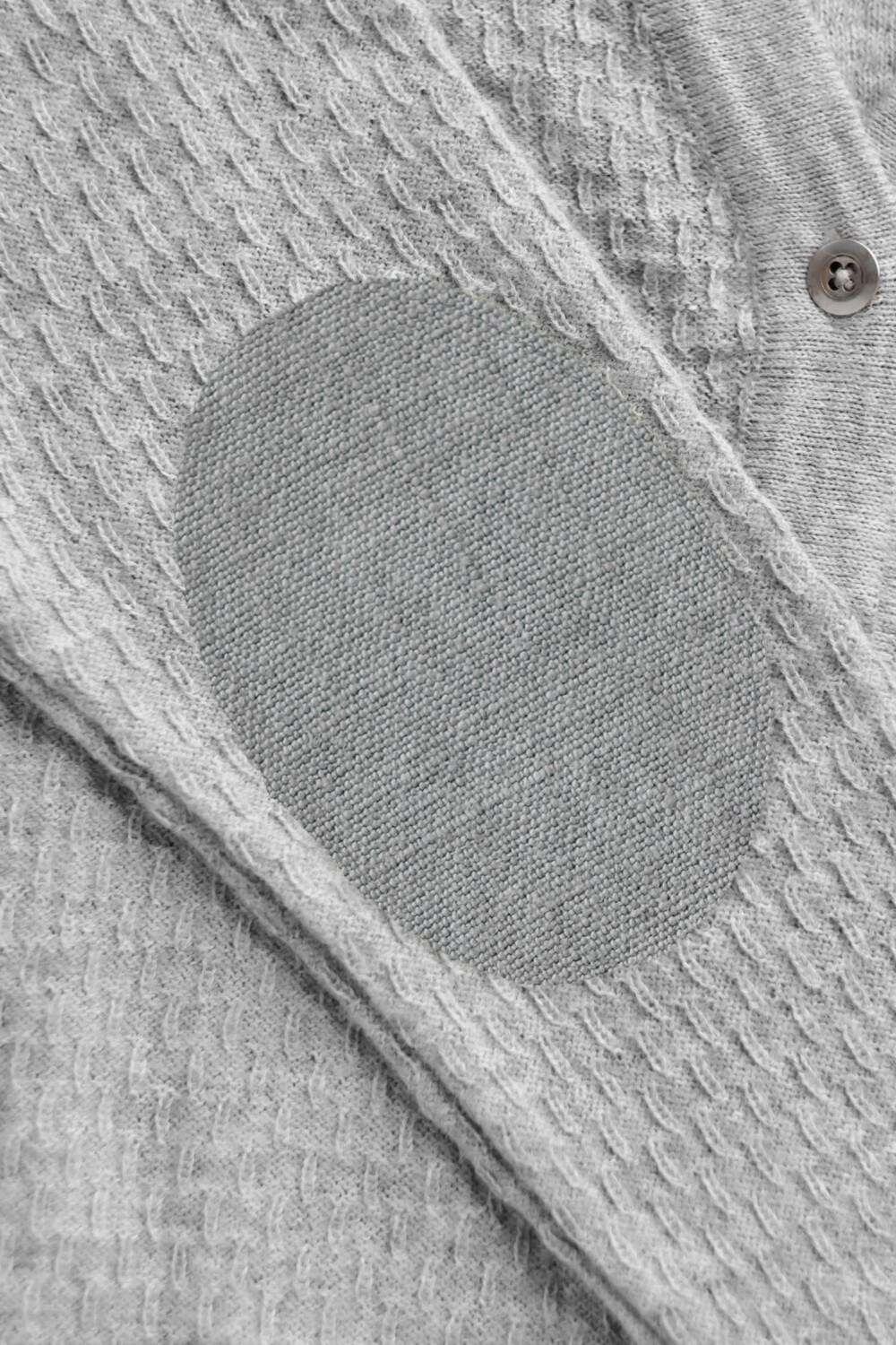 Kyynärpaikkaus - Image 3